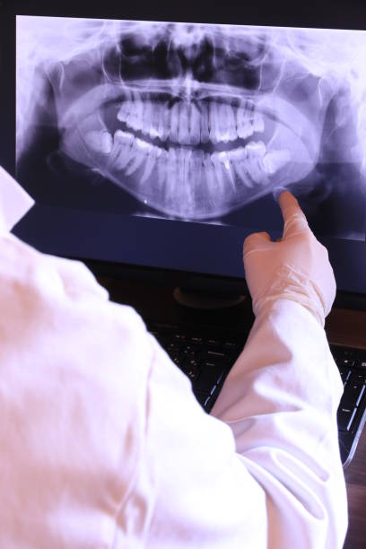 Best Urgent Dental Care for Toothache in Sandersville, GA