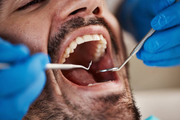 Best Orthodontic Emergency Dentist in Sandersville, GA